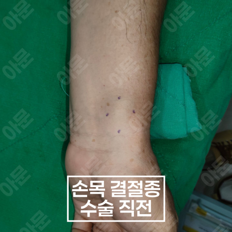 삼성서울정형외과 이미지