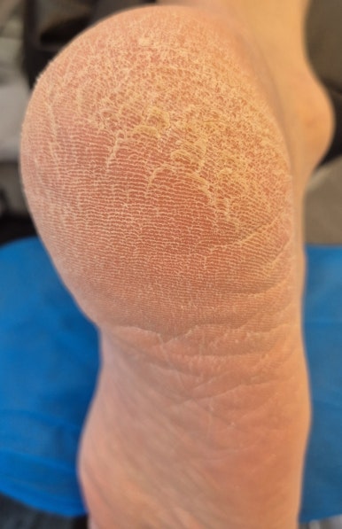 블라썸뷰티 동성제약 풀리메디 영종점 이미지