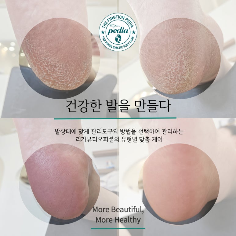 리가뷰티오피셜 이미지