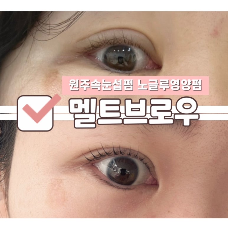 멜트브로우 이미지