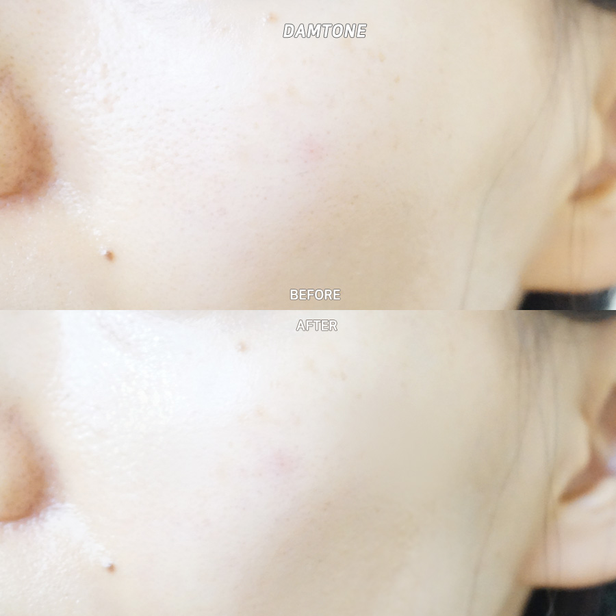 더블유기 이미지