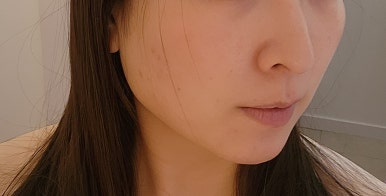 보테에스테틱 이미지