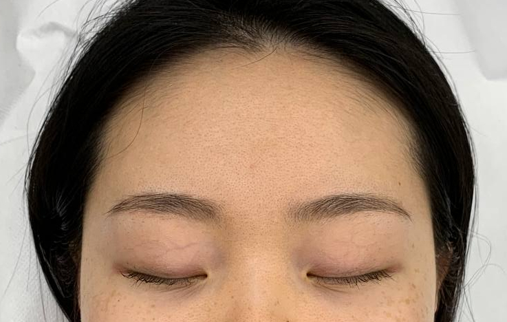 엘케이헤어 이미지