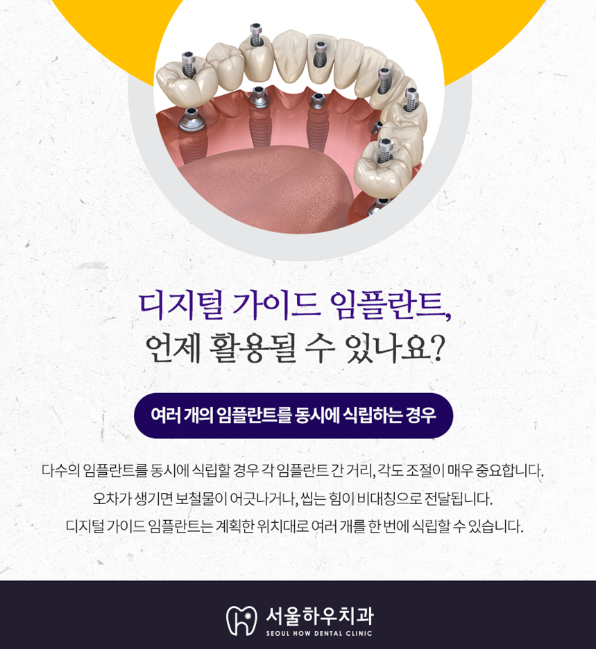 서울하우치과 이미지