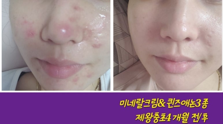큐사랑 이미지