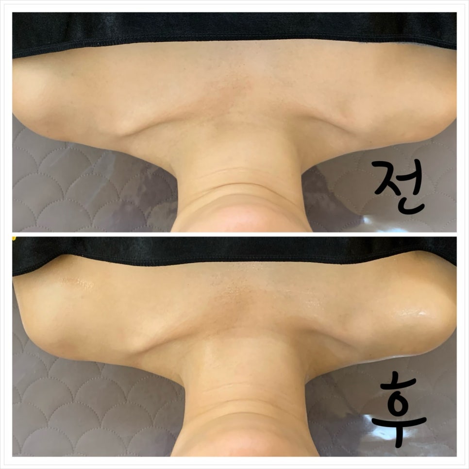 바디슬림미 이미지