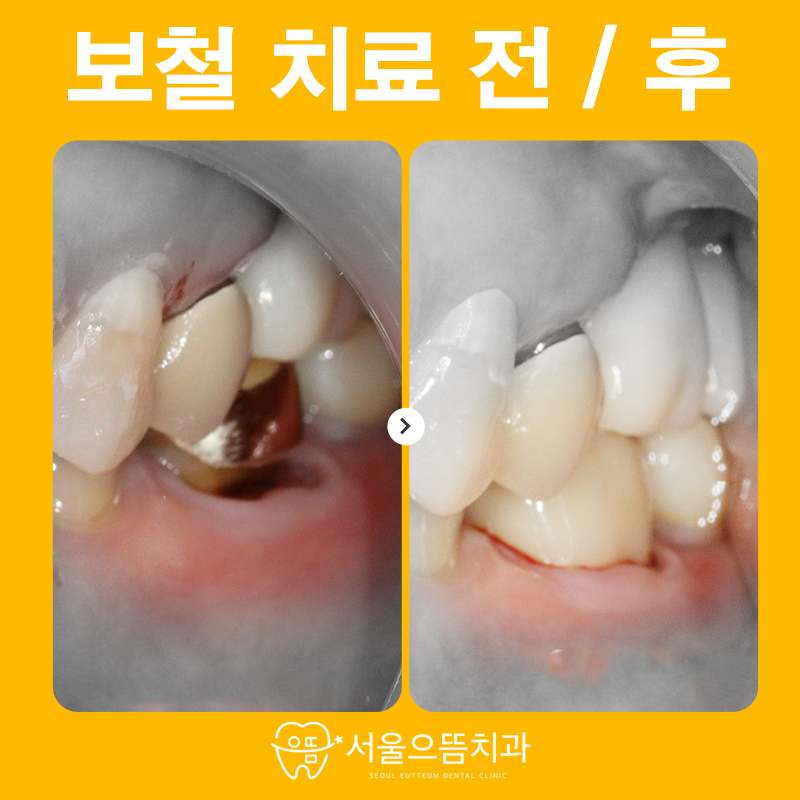 서울으뜸치과의원 이미지