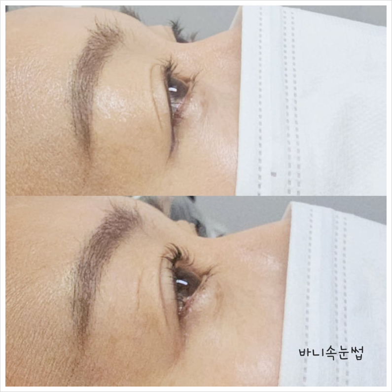 바니속눈썹 이미지