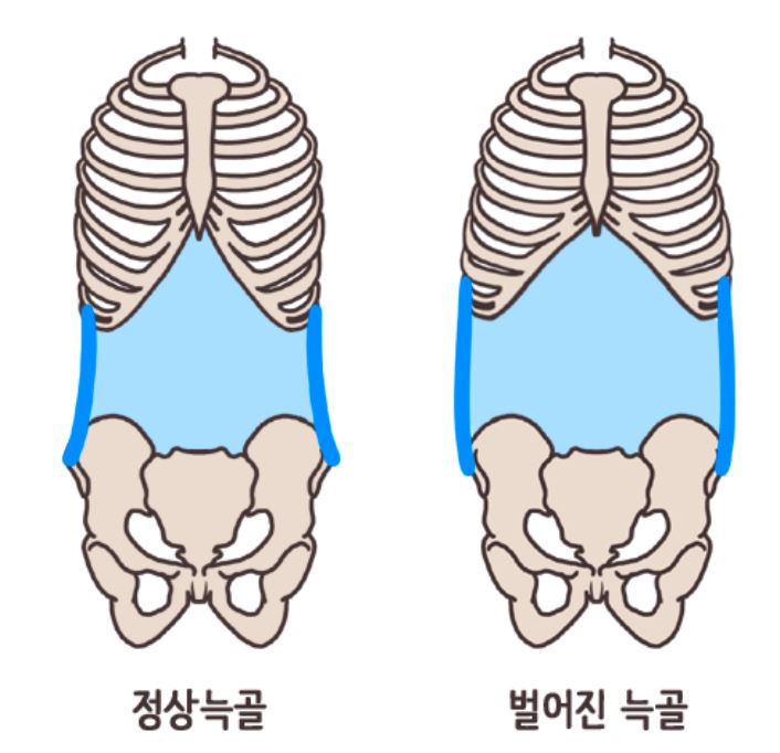 필라테스;단 이미지