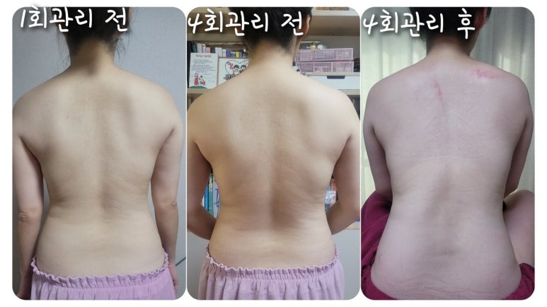 성남출장마사지 이미지