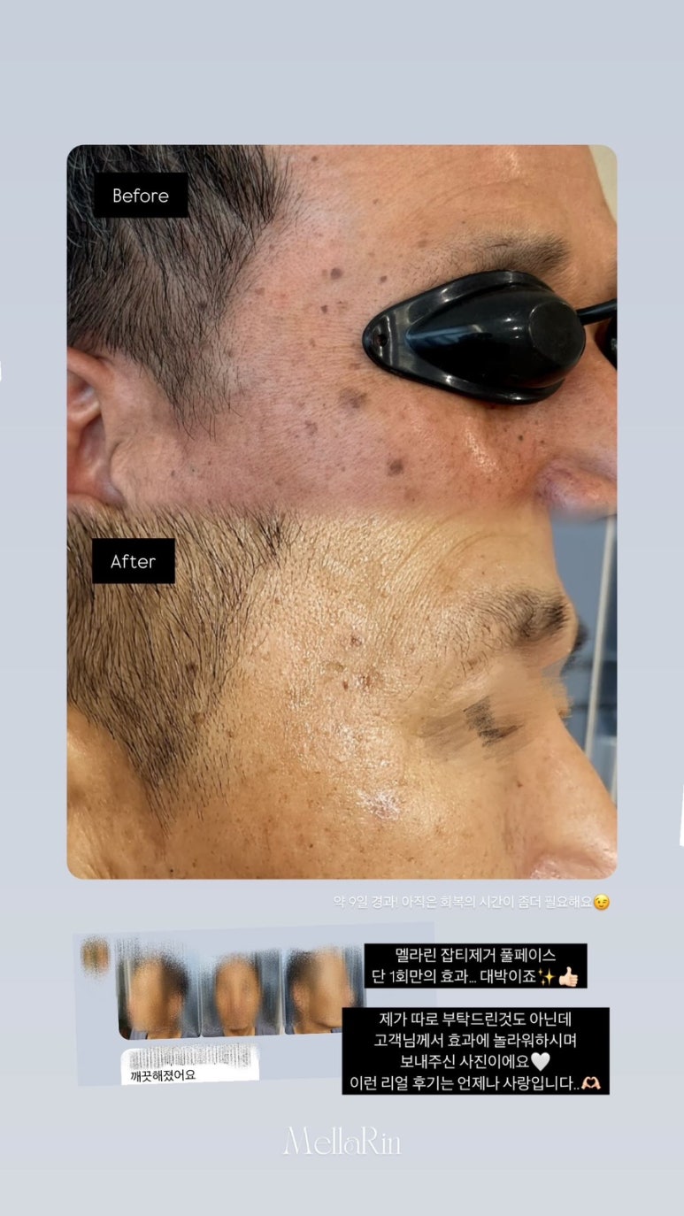 어랏뷰티 이미지