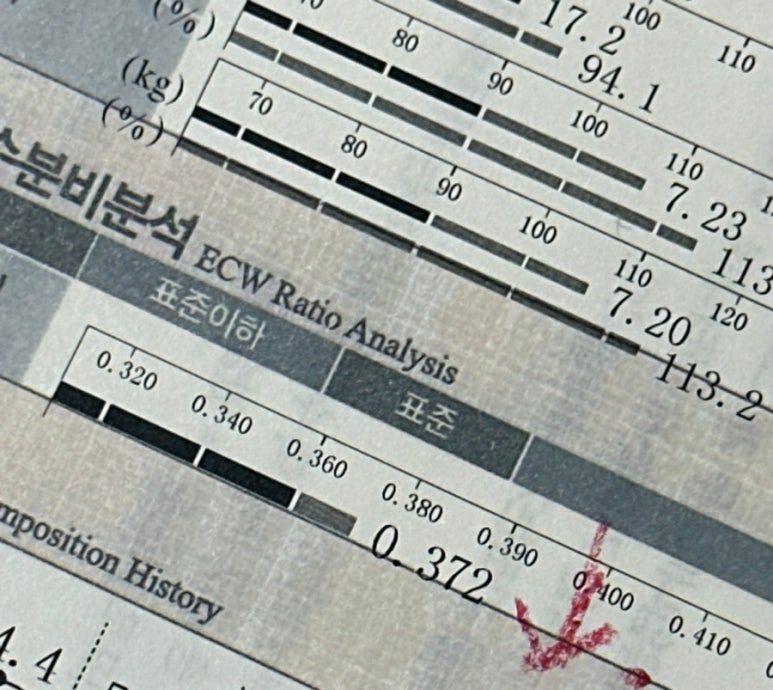 본어겐 이미지