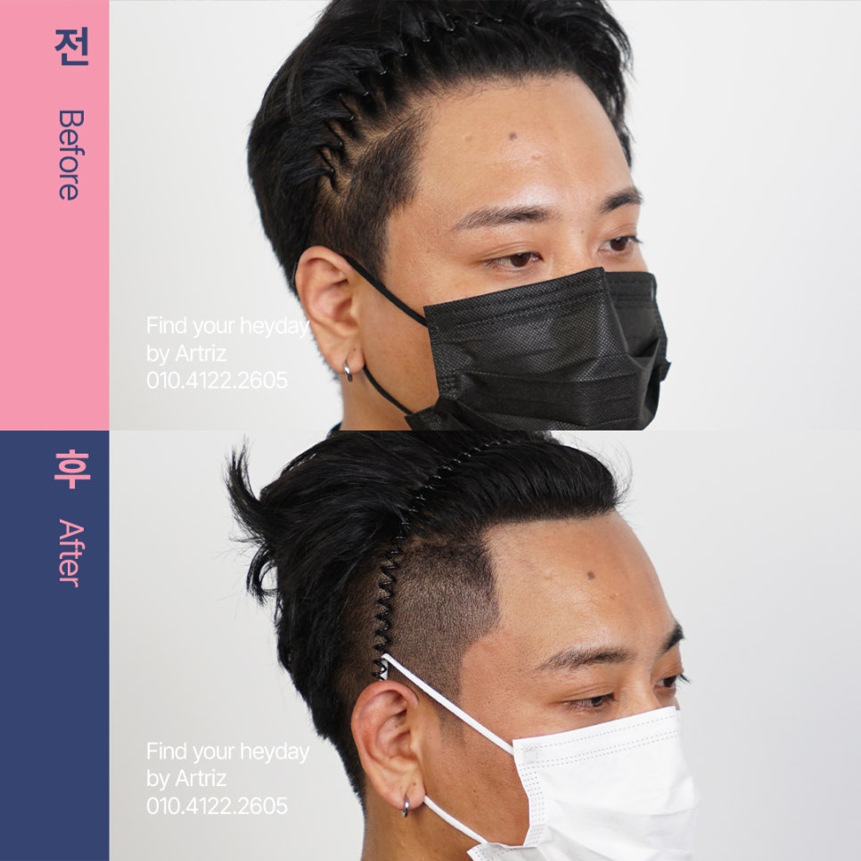 미미헤어라인 이미지