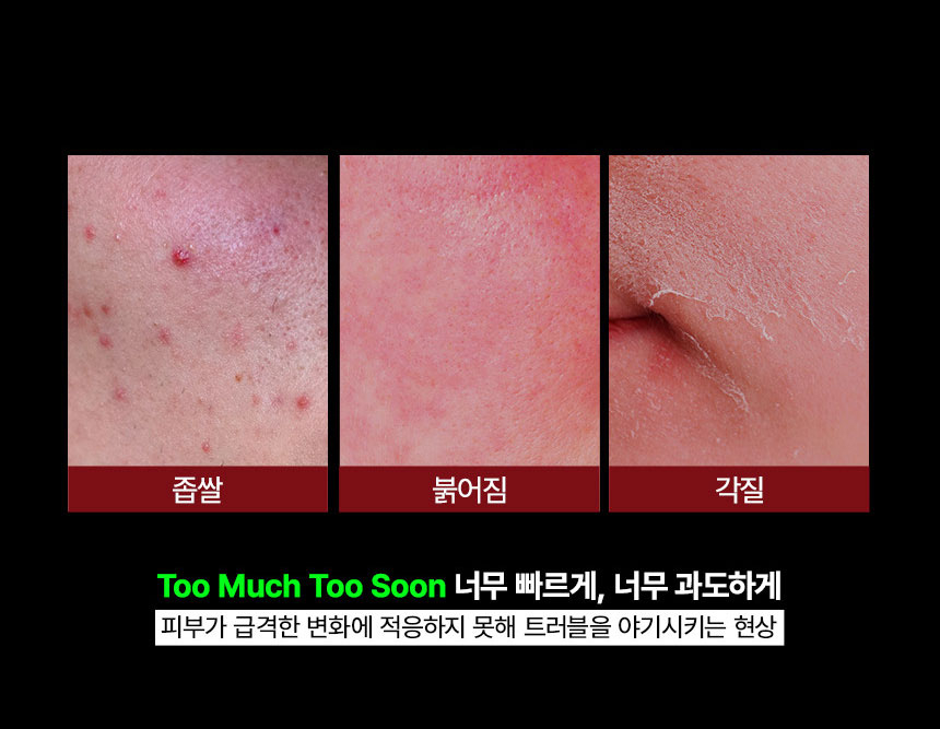뱅상판두 이미지