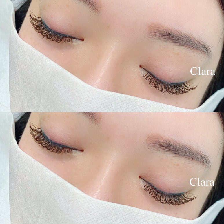 뷰티라인 이미지