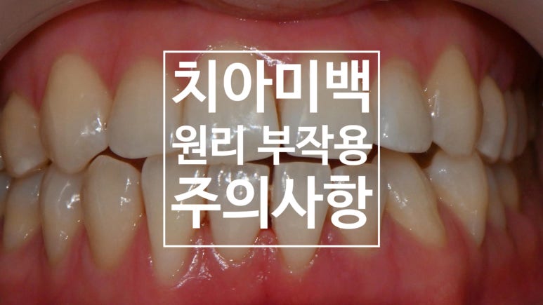 연세내이로치과 이미지