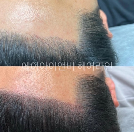 헤어앤비 이미지