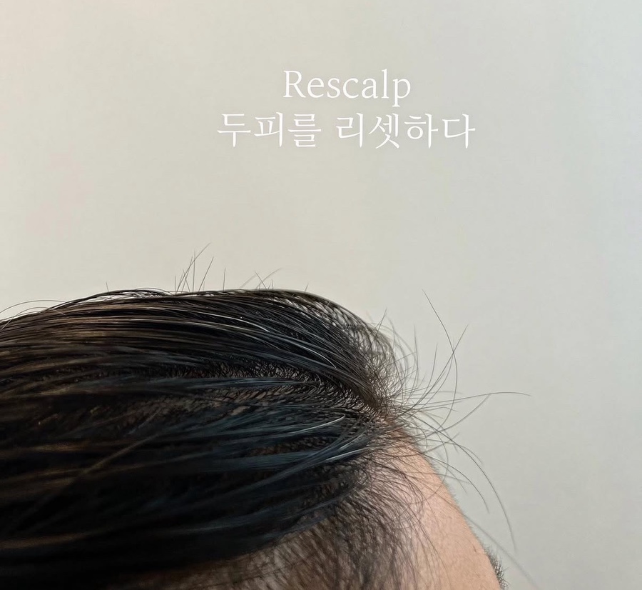 리스칼프 이미지