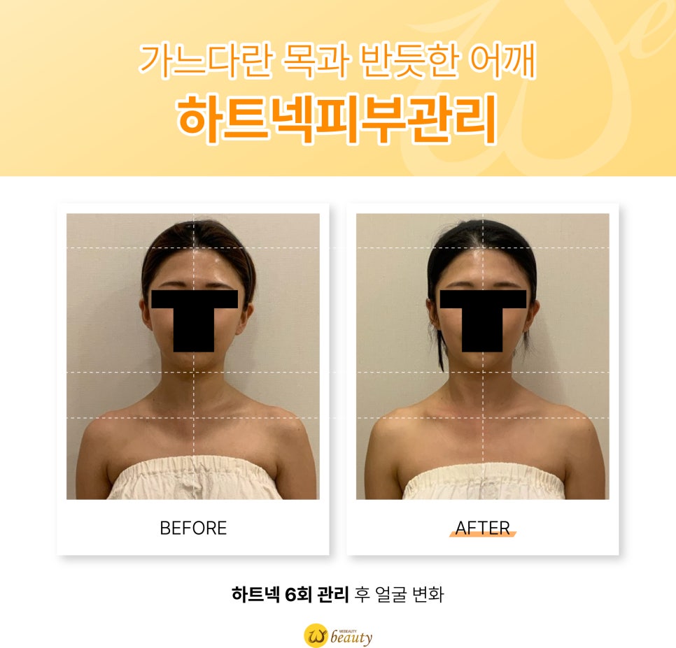 위뷰티 이미지