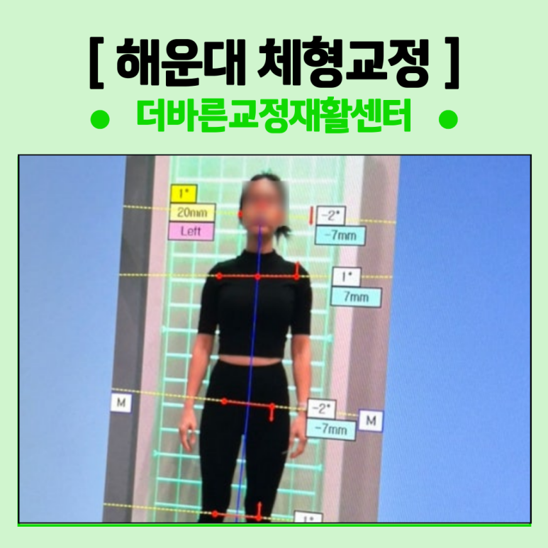 더바른교정재활센터 이미지