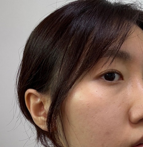 로로스킨케어 이미지