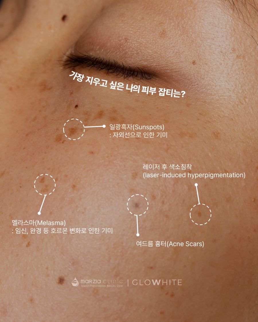 글로우에스테틱 이미지