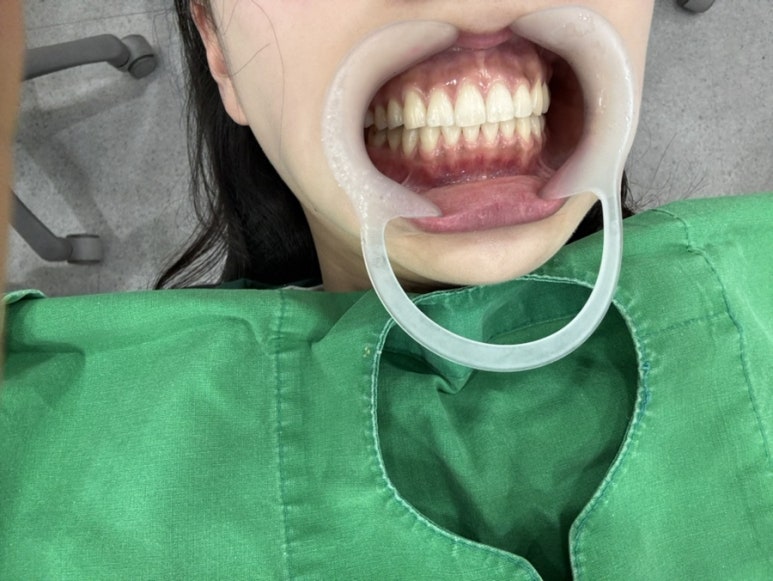 조은미소치과 이미지