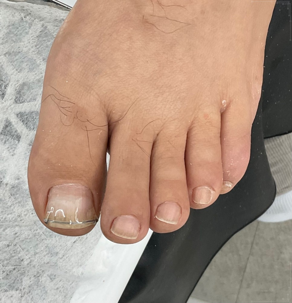 발라발라네일 이미지