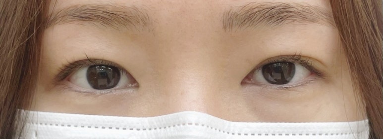 디뮤어뷰티 이미지