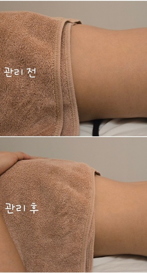 서초에스테 이미지