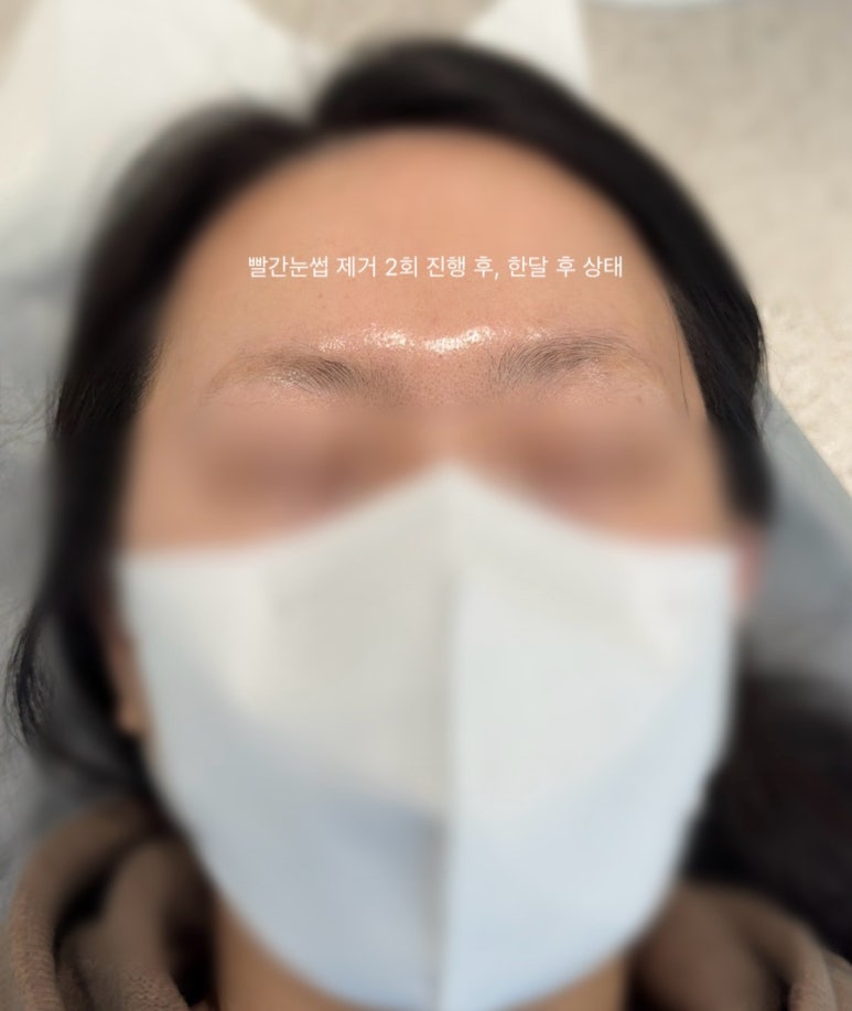 어랏뷰티 이미지