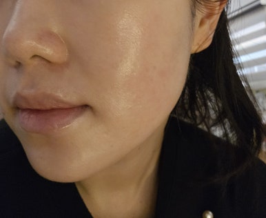 퓨어스킨앤바디 이미지