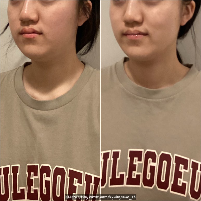 고은바디케어 이미지