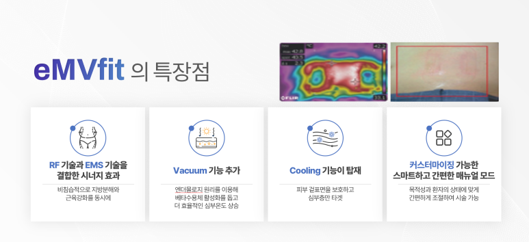 엠브이핏 이미지