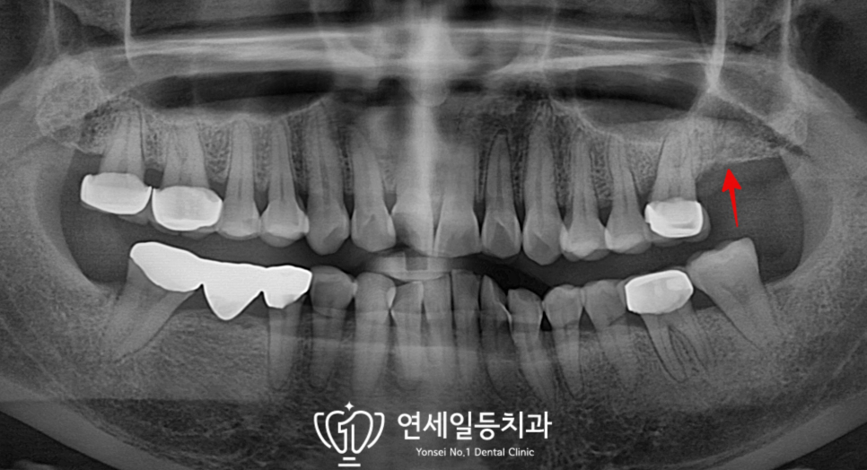 연세일등치과의원 이미지