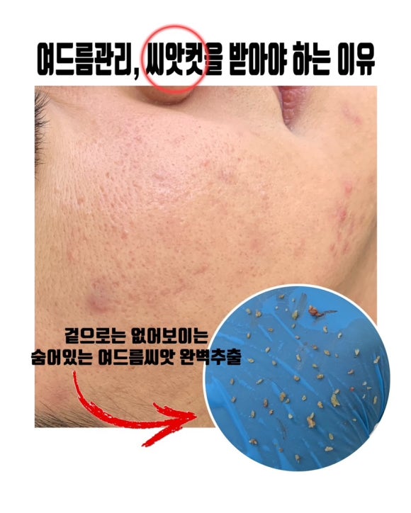 선에스테틱 이미지