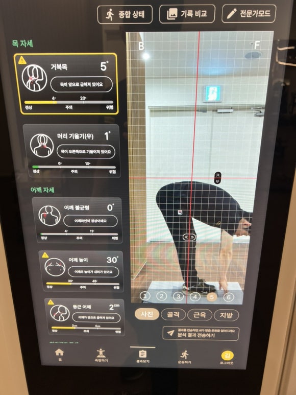 피트릭스 이미지