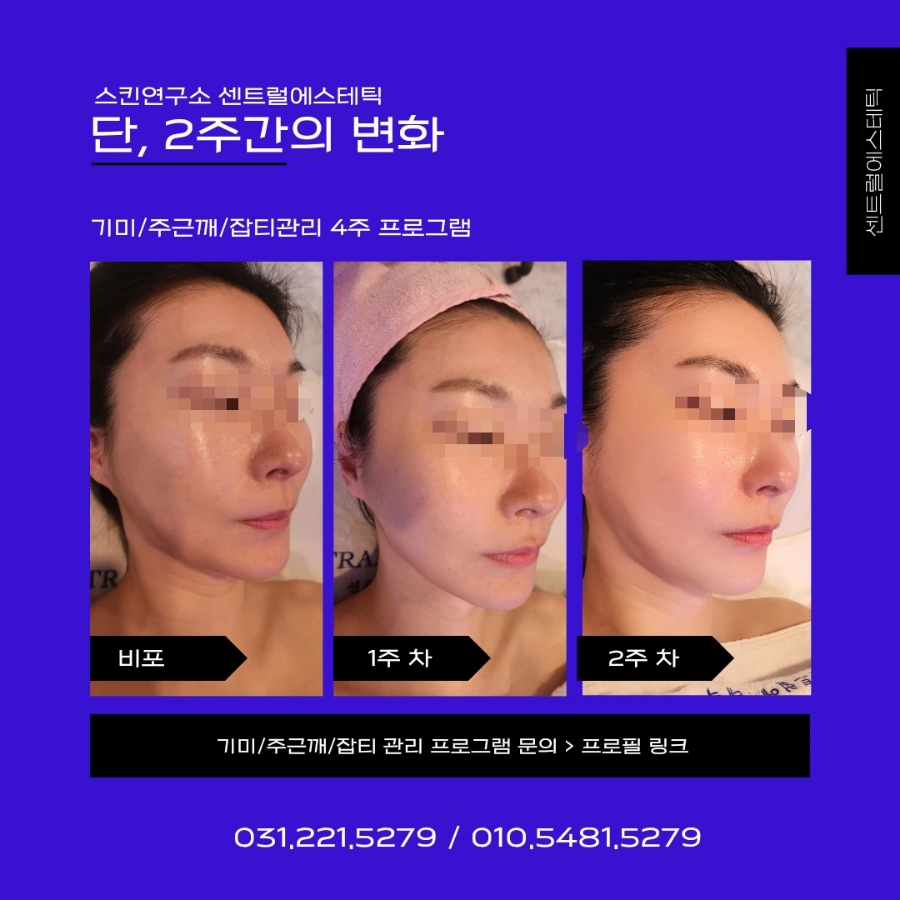 센트럴에스테틱 이미지