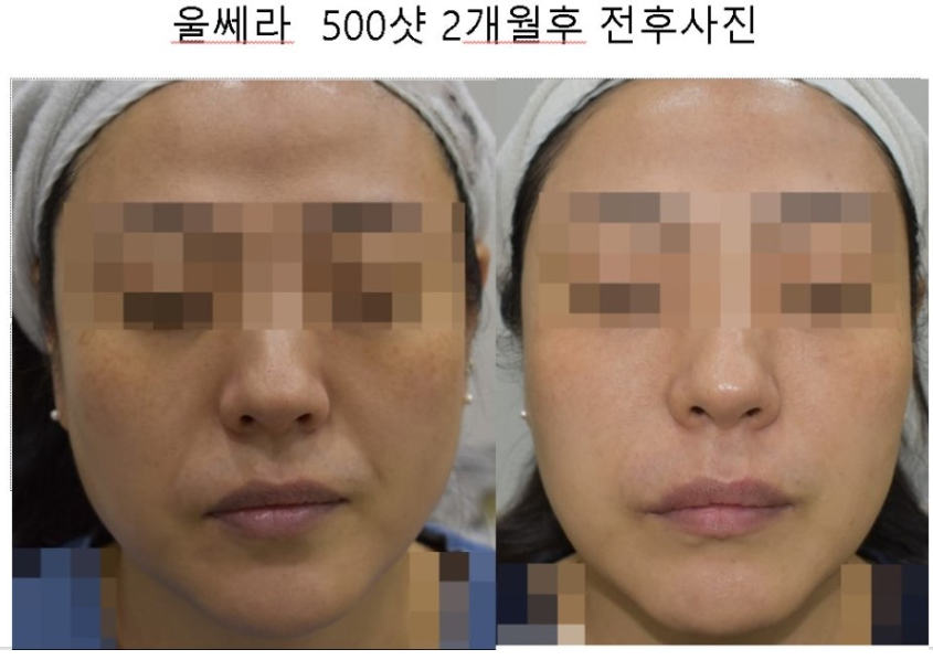 닥터지니 이미지