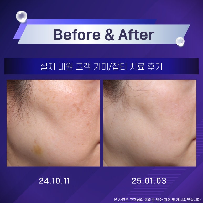 본피부과 이미지