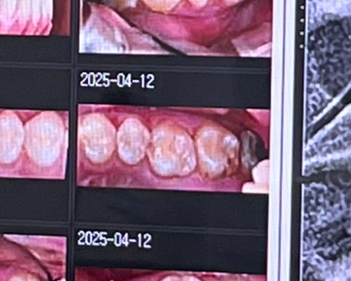 서울더편한치과의원 이미지