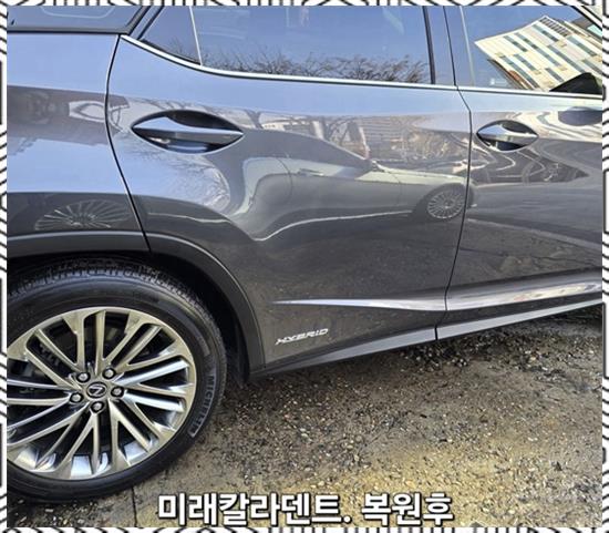 미래덴트칼라 이미지