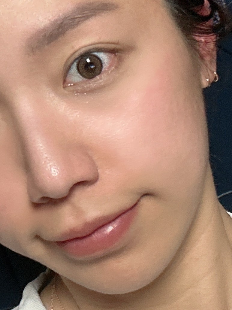 인베이스 이미지