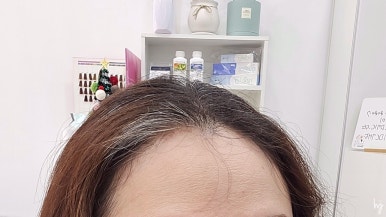 리리클헤어 이미지
