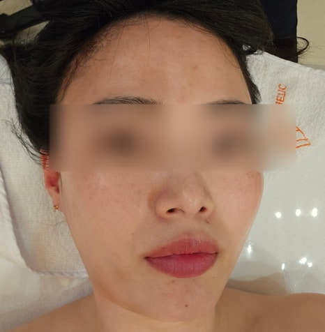라베니 이미지