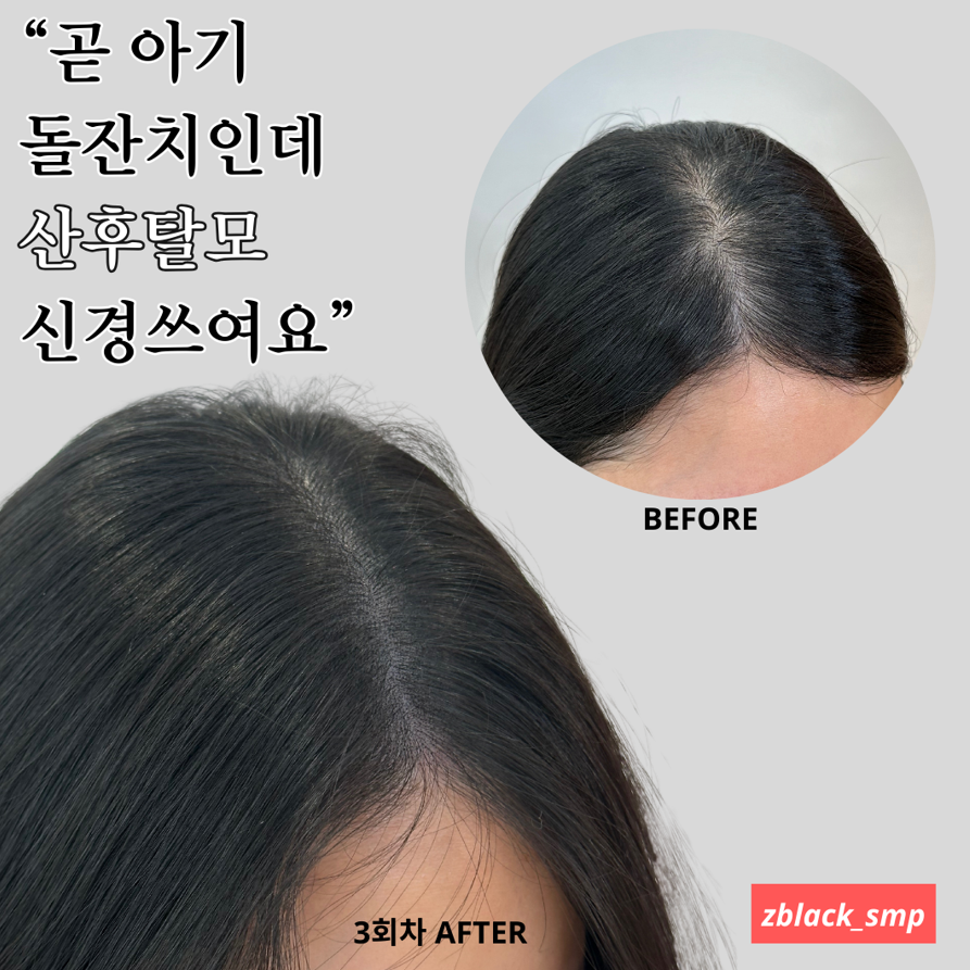 제트라인 이미지