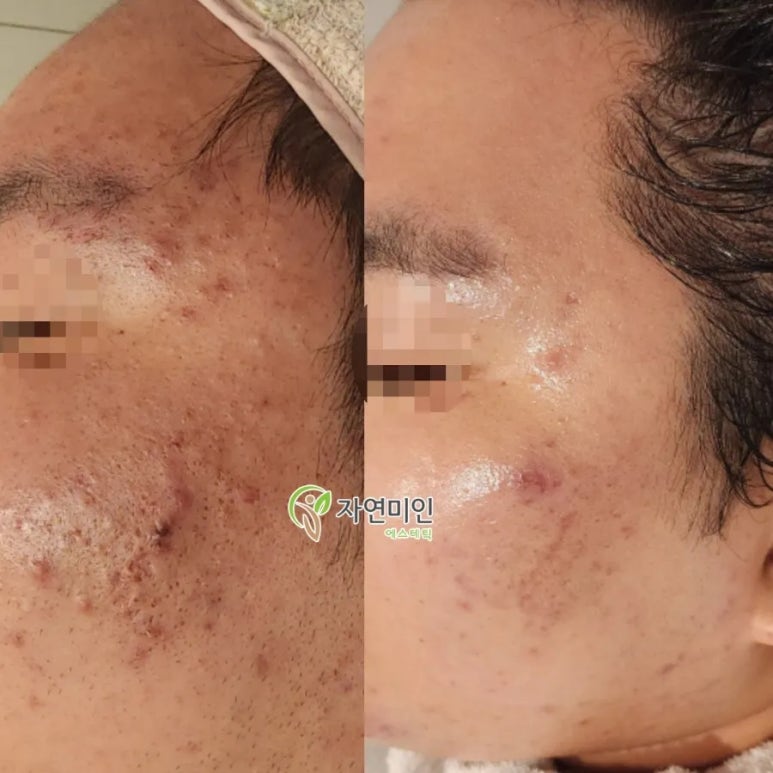 자연미인에스테틱 이미지