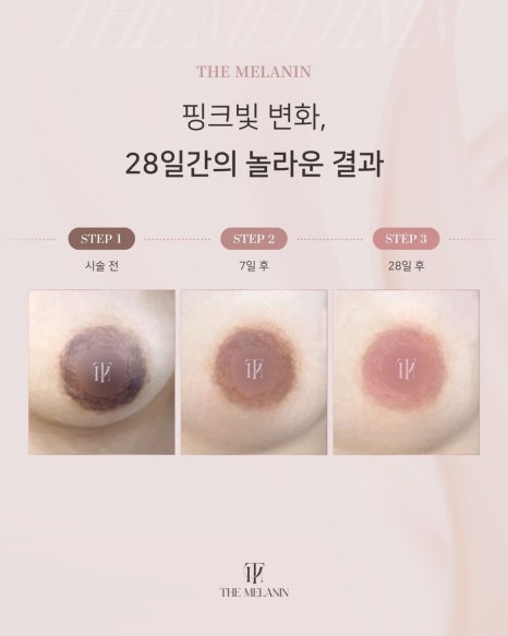 보인케어 이미지