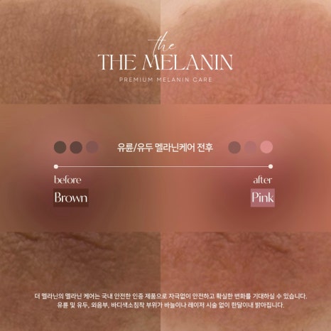 보인케어 이미지