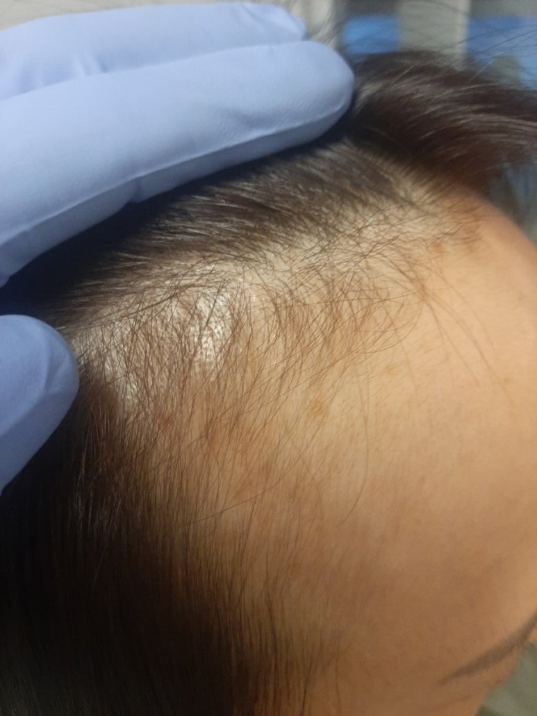 숲칼프가산두피탈모전문센터 이미지